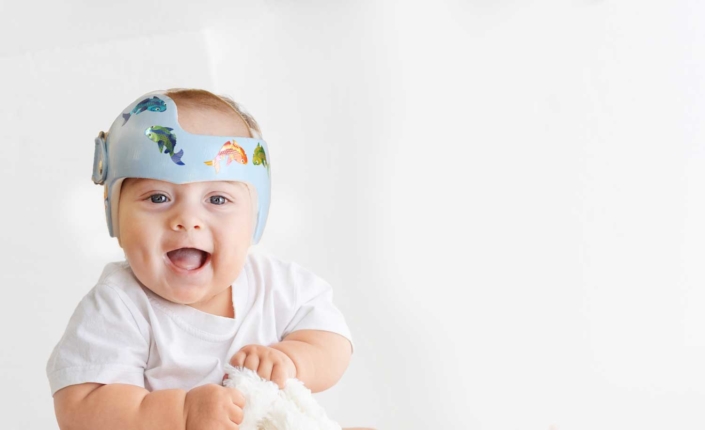 Plagiocephaly-treatment 