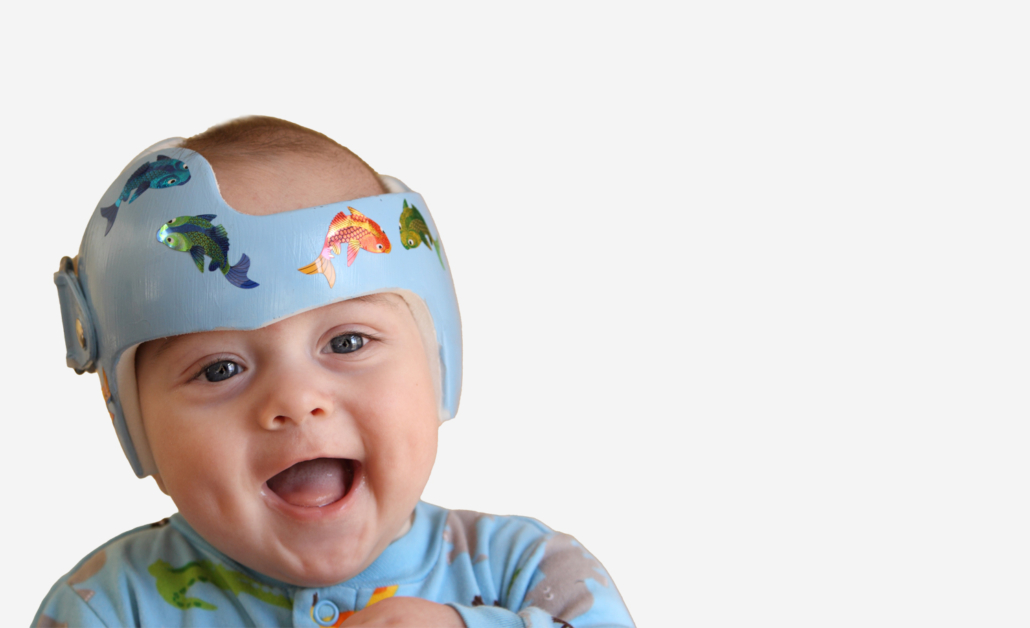 plagiocephaly-treatment | CRS - Multi specialty Phoenix Pediatrics Clinic