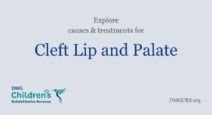 Cleft Lip and Palate